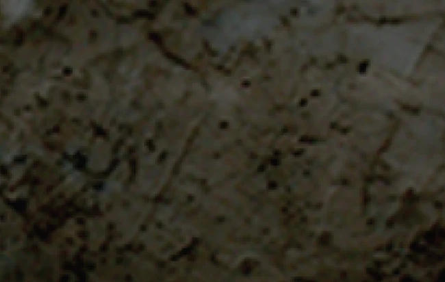 Cement Layer Removal